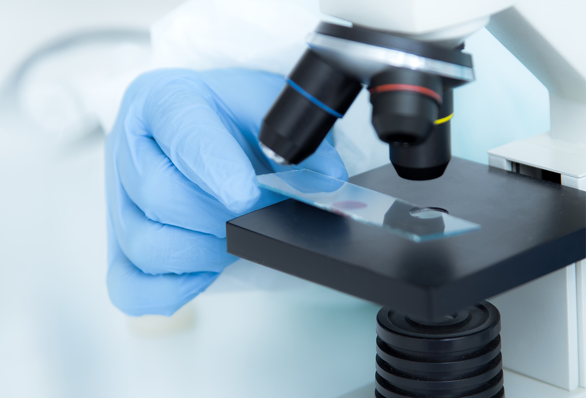 G6PD欠損症検査と病理学的検査を行う様子